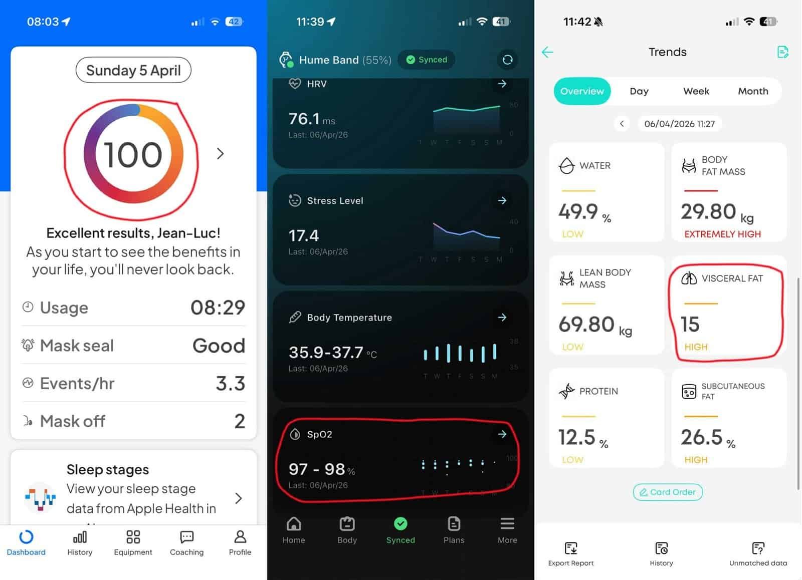 cpap therapy results