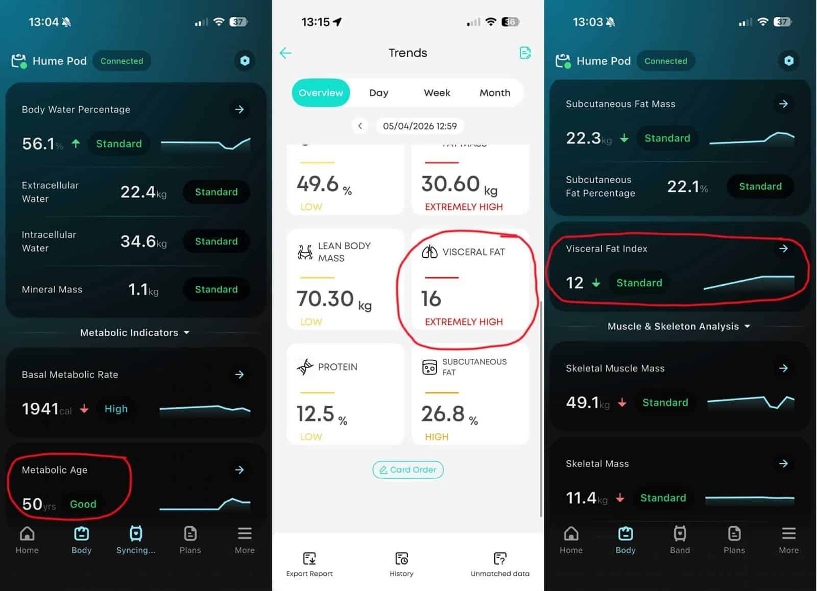 losing weight with sleep apnea